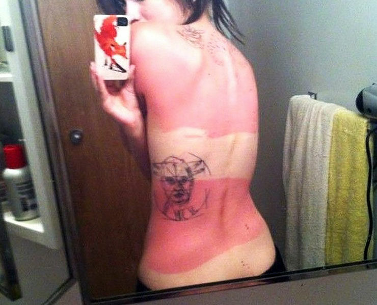 These People Stayed Out In The Sun A Little Too Long And Look What Happened