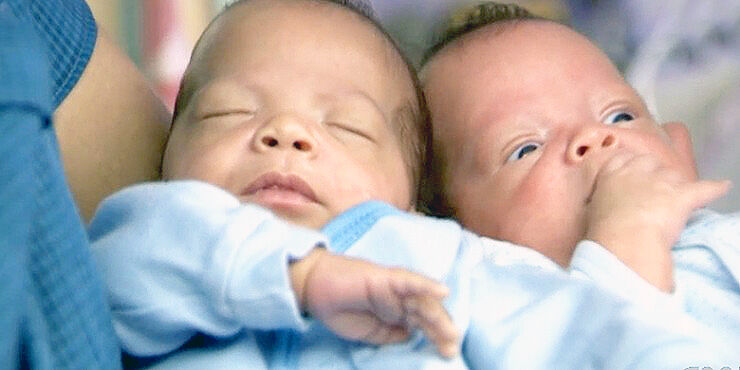 Twin Brothers That Were Born 24 Days Apart.
