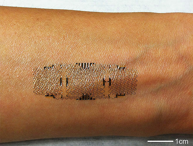 Subdermal Implant Smart Tattoo.