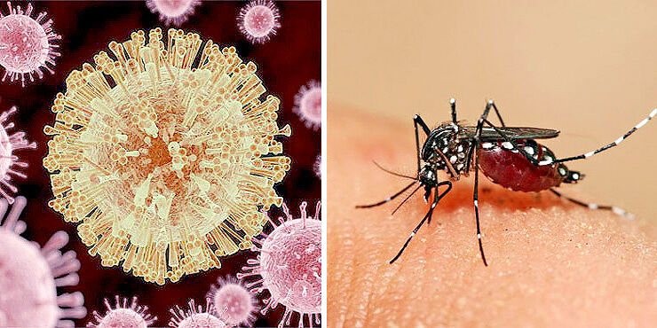 zika-virus-740x370