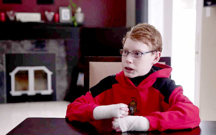 Butterfly Boy Jonathan Pitre 01.