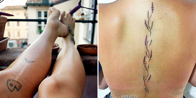 Amazing Tattoos That Make Creative Use Of Body Scars 01.